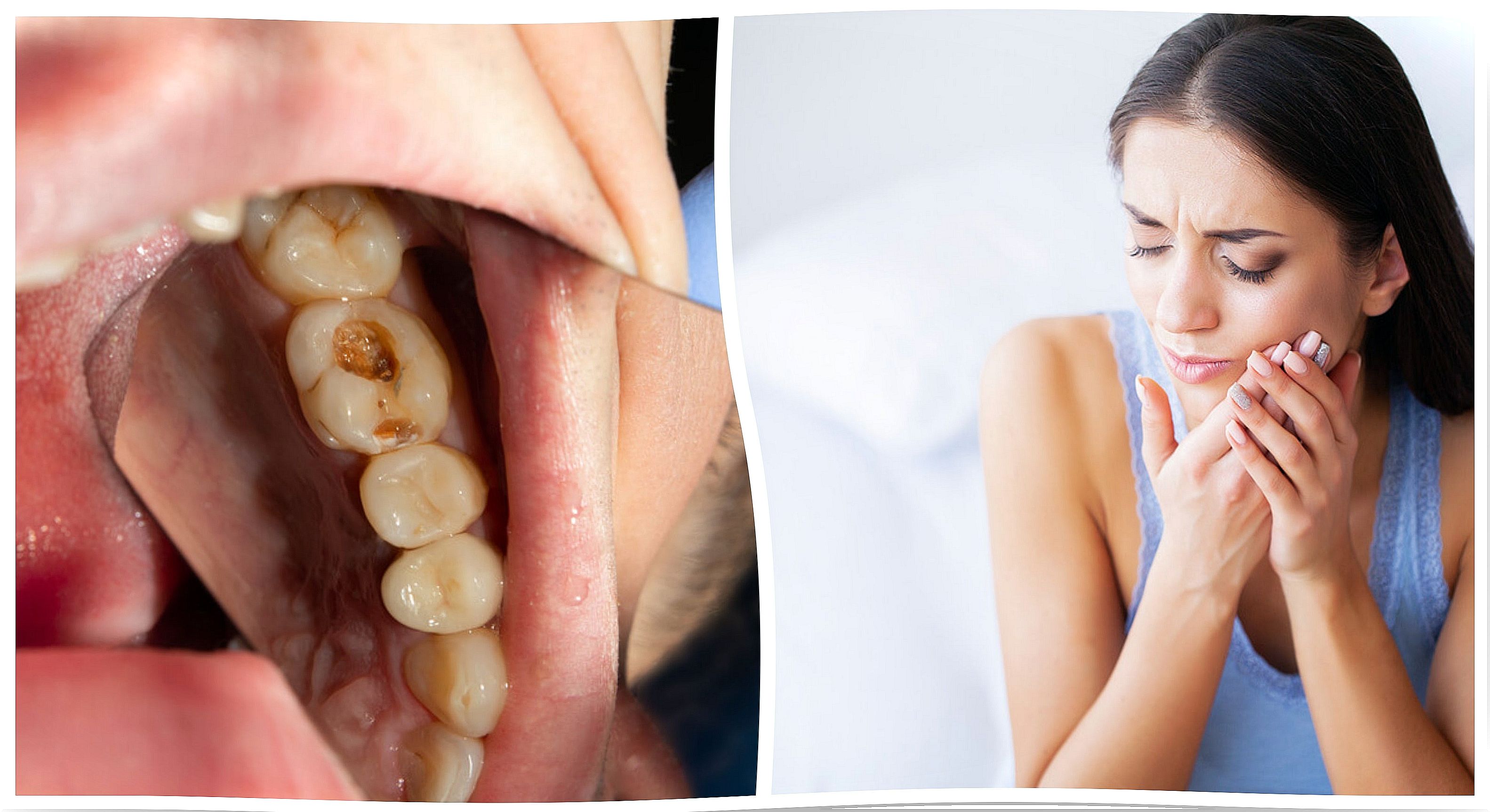 7 symptoms that alert you to a dental infection