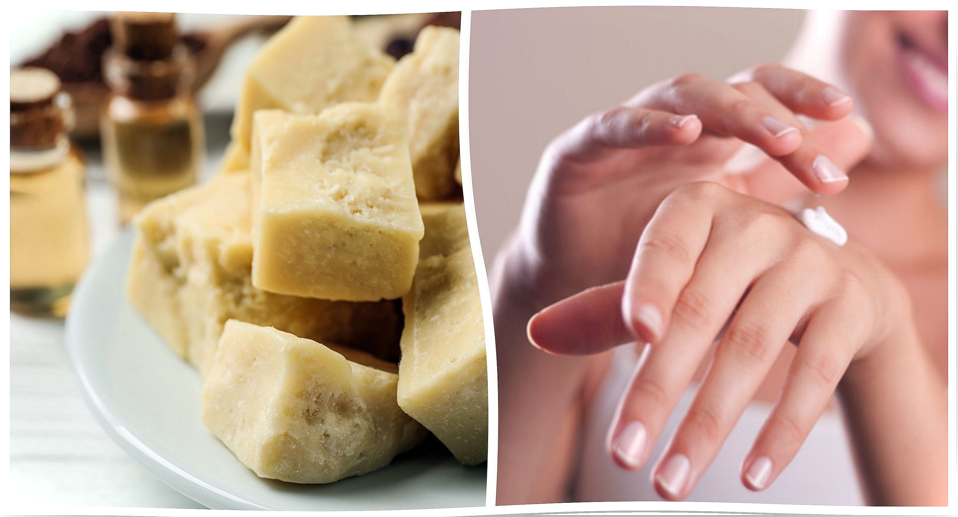 Are your hands and cuticles dry?  Do not stop trying this home remedy