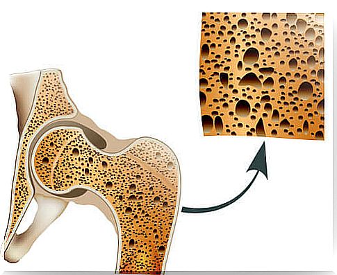 Take care of the bones and prevent osteoporosis