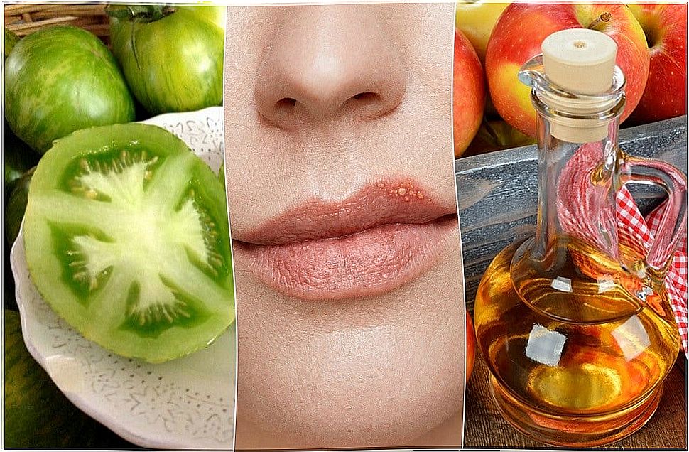 How to fight cold sores with 5 natural treatments