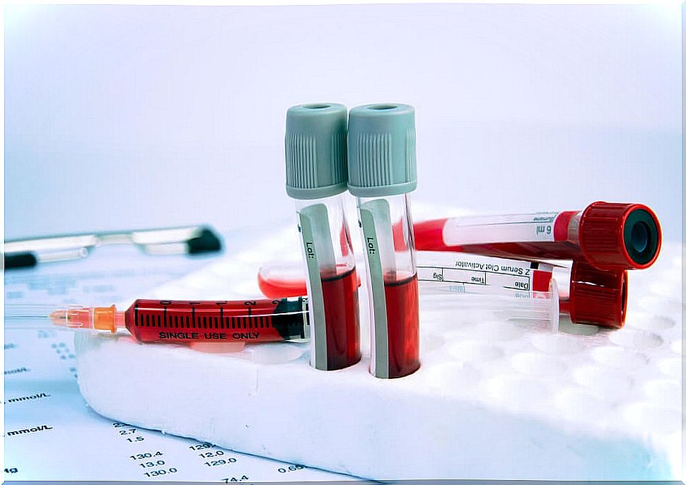 Fasting plasma glucose