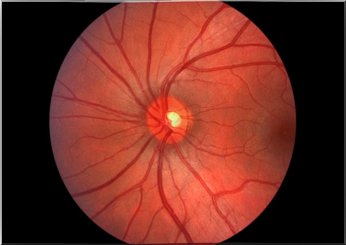 Eye fundus.