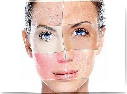 Why is our skin dry, combination or oily?